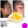Egg soap